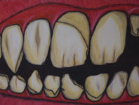 Poverty: Oral Care
Copyright © 2010 David M Bandler, All Rights Reserved.
